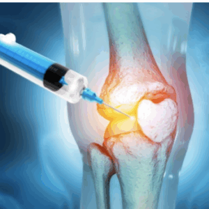 Factor de Crecimiento TERAPIA REGENERATIVA - 3 Sesiones